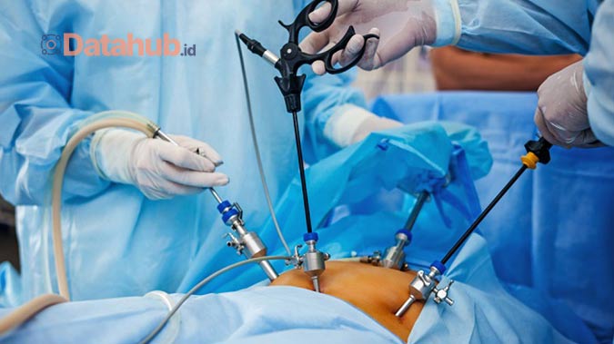 Pengertian laparoskopi sebagai metode operasi